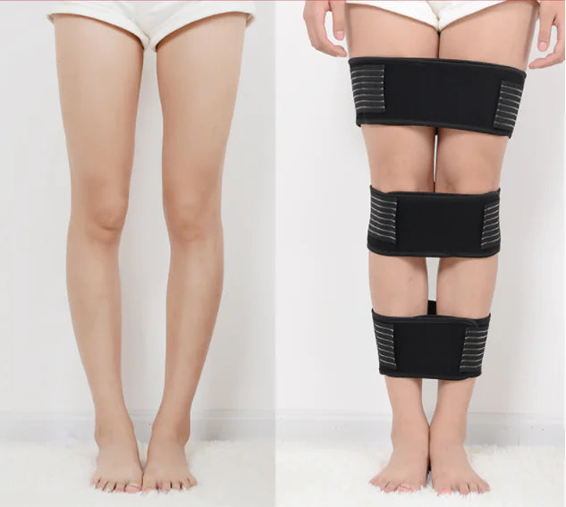 XO Leg Correction Strap for Bow Legs and Straightening